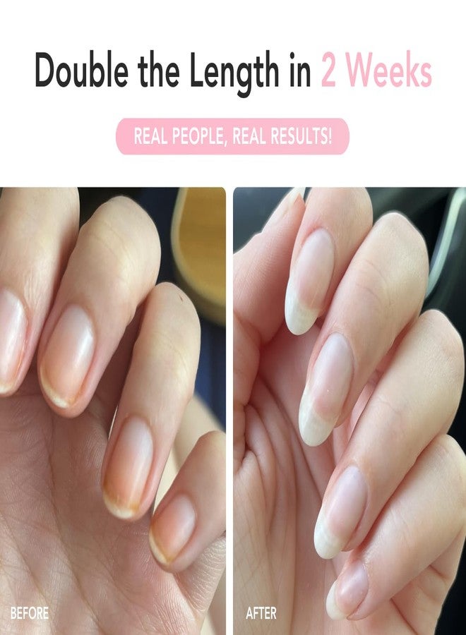 Liaison UltraGrow Nail Serum for Growth and Strength with Keratin Complex, Olive Oil & Vitamin E | Dermatologist-Tested to Support Weak, Brittle, Splitting Nails - Image 4